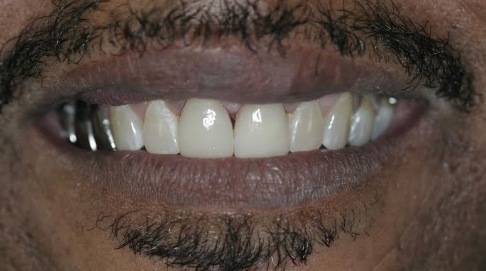 White healthy smile