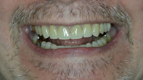 White healthy smile after dental treatment