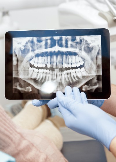 Digital dental x-rays on tablet computer